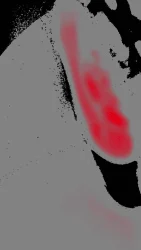 Interference