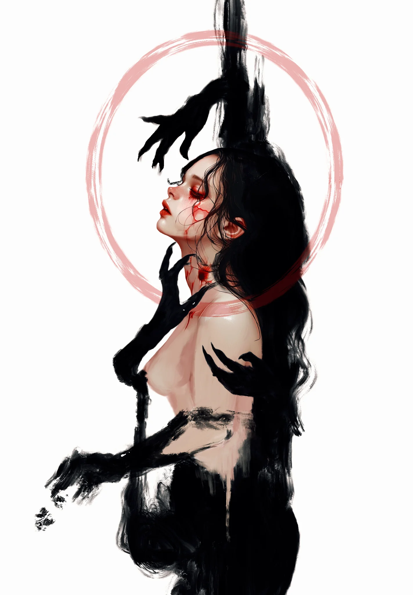 Hurt
