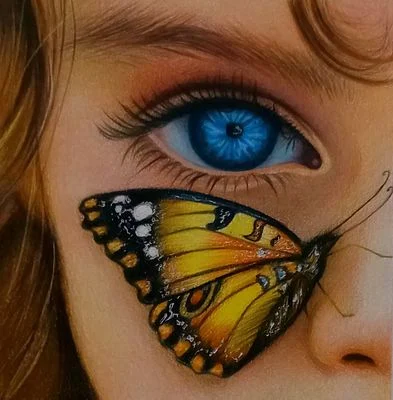 Eb ( Butterfly disease)